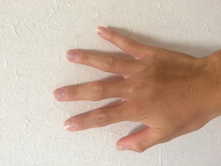 忘れられない 不透明な 説明する 指 関節 太い 治す Salonde Noir Jp