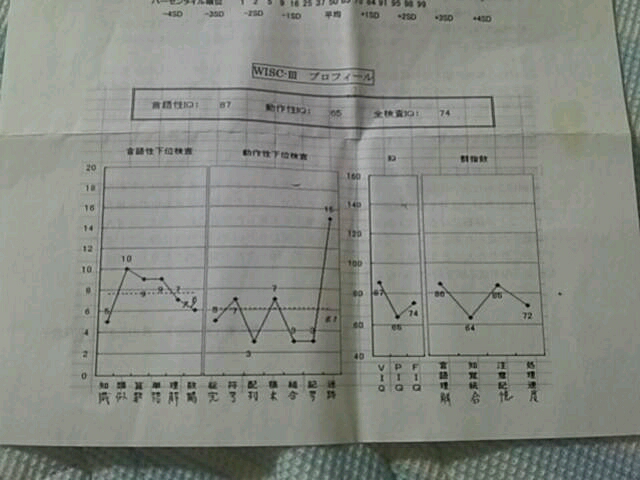 このIQで大学に行けたのは奇跡ですか？ - 一般受験です。偏差値4