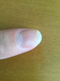 質問です 爪が写真みたいに白い爪しか伸びなくて ピンクの爪が Yahoo 知恵袋