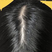 女子高生です 毎日お風呂で40本ほど抜けてドライヤーだけでも10本 Yahoo 知恵袋