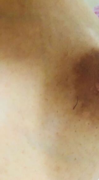 脱毛に詳しい方教えてください 女ですが乳首に一本だけすごく濃い毛が生えていま Yahoo 知恵袋