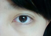 この目の下のクマがずっと消えません 骨格なのか 小さい頃からずっと Yahoo 知恵袋