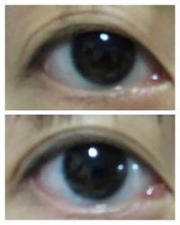 男 学生です アイプチについて 瞼が厚く通常時は一重で 見開くと末広二重に Yahoo 知恵袋