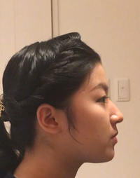 自分の横顔がコンプレックスです この横顔はどう思いますか Eラインはあります Yahoo 知恵袋