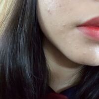 アシュランを初めました 吹き出物くすみ毛穴が気になりお肌の綺麗な方に Yahoo 知恵袋