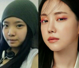韓国人女性アイドルではやはり鼻の整形が主流なのでしょうか 韓 Yahoo 知恵袋