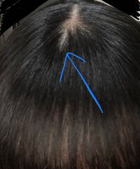 前髪につむじがあり そこからパックリ割れてしまいます これはどうしたら治りま Yahoo 知恵袋