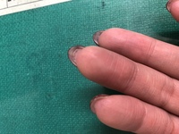 半年ほど前からジェルネイルをしています 爪の下 裏 から薄い爪 皮 Yahoo 知恵袋