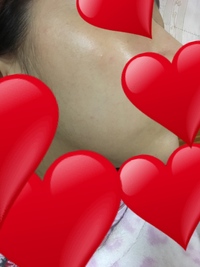 乾燥肌 アルージェの使用を考えております 顔の乾燥が酷いです 顎 Yahoo 知恵袋