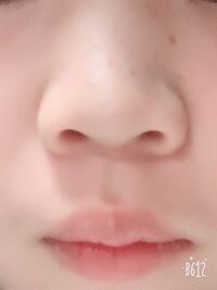 痩せると 鼻の肉はとれてすっとしたり 鼻筋が通ったり 鼻幅がせまくな Yahoo 知恵袋