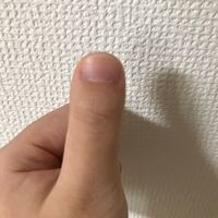 親の遺伝で親指の爪の形がこんなですり 削ったり切ったりしても中々治りませ Yahoo 知恵袋