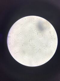 なんの虫でしょうか 2週間ぐらい前に買ったじゃがいもに虫が湧 Yahoo 知恵袋