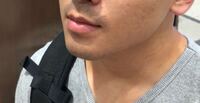 鼻の下の青味が気になります 女です ２０才くらいから気になり始 Yahoo 知恵袋