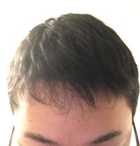 短髪から伸ばしていってこのようになりました このスカスカは薄 Yahoo 知恵袋