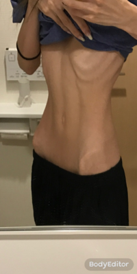 私は 痩せすぎ とか ガリガリ って言われるととても嬉しいし興奮します 小学 Yahoo 知恵袋