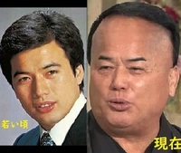 細川たかしってなんであんなに顔がパンパンになったんですか 今うたコンみて Yahoo 知恵袋