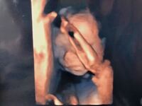 胎動 しゃっくり お腹の中の赤ちゃんが一定のリズムで ピクピクするこ Yahoo 知恵袋