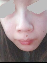 閲覧注意 中3女子です 鼻が大きいのがすごくコンプレックスです 痩せたら小 Yahoo 知恵袋