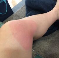 友達が明らかにホモレイプされてしまったみたいなのですが どう接していいかわかり Yahoo 知恵袋