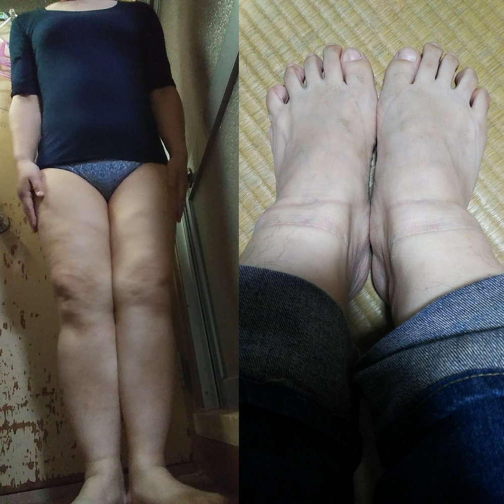 デブ ミニスカ 街撮り デブのミニスカートはありかなしか。詳細や体型については、前回の質問... - Yahoo!知恵袋