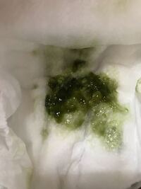 風邪気味の5ヶ月の赤ちゃんのうんちが緑色になりました この色 Yahoo 知恵袋