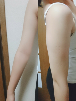 二の腕 太い 女 画像