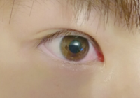 目が赤くなるまで泣くと目が二重になるのですが なぜですか 腫れると一重になる Yahoo 知恵袋