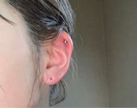 ピアス穴の分泌物は膿ですか ピアス開けて４週間になります 痛みなどはなく Yahoo 知恵袋