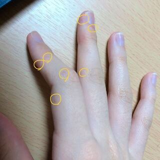 ダコ ミイヒ 吐き