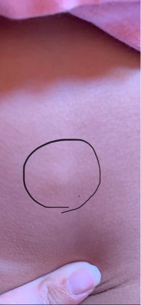 小学1年生の男の子です 先日からお腹に1センチほどの丸くて硬いしこりが Yahoo 知恵袋