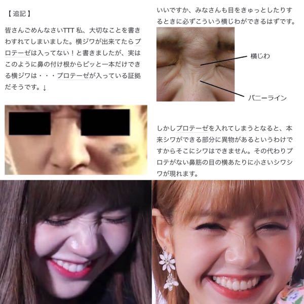 Blackpinkリサ鼻整形 リサって整形疑惑でてましたがこれを見ると違 Yahoo 知恵袋