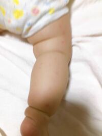 赤ちゃんのほくろ生後7ヶ月の娘がいます 腕にほくろができたんですが Yahoo 知恵袋