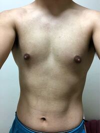 26歳男子です 胸が出ているように見えるのですが これは女性 Yahoo 知恵袋