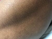 高2の男子です 両親はどちらも日本人で比較的肌は白く 自分合わせて Yahoo 知恵袋