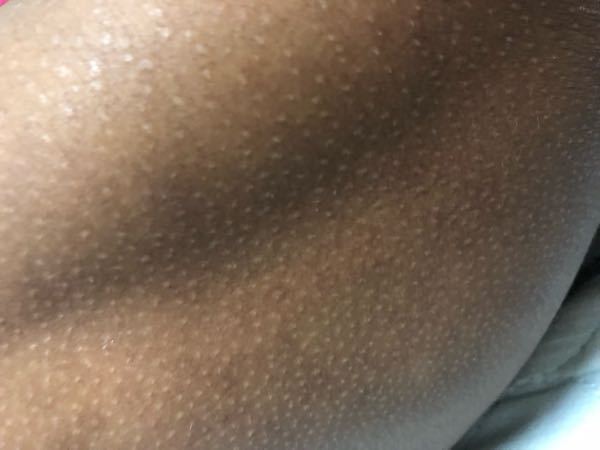 高2の男子です 両親はどちらも日本人で比較的肌は白く 自分合わせて Yahoo 知恵袋