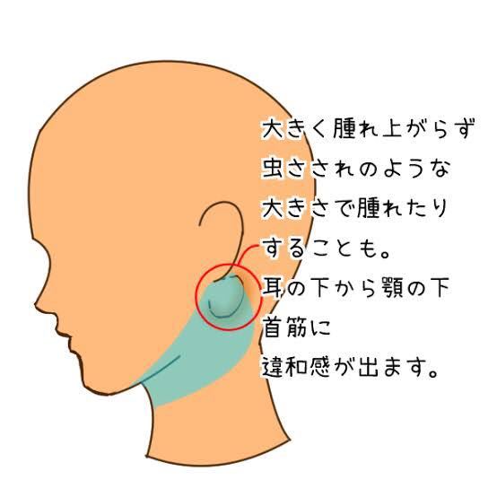 右側の耳の下に小さいできものができて、右顎辺りを触ると左側に比べて 