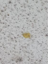 この卵は虫の卵ですか 虫の卵だとしたら虫は なんでしょうか Yahoo 知恵袋