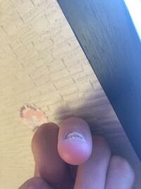 バイトの時作業をしてると爪の間に何かが挟まり爪が剥がれ血がたくさん Yahoo 知恵袋