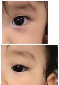10ヶ月の娘の目です 目を開けるとガッツリ一重ですが 半目だと奥二 Yahoo 知恵袋