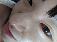 家にあるもので簡単に鼻の毛穴を綺麗にする方法教えてください Yahoo 知恵袋