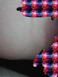 あそこの穴の周りの皮膚がクッキリと黒いのですが、どうしたら白くなりますか？ 
