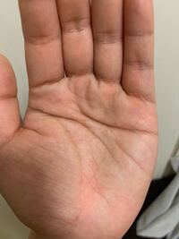 手相のわかるかた よろしければ太陽環について教えてください 女性 Yahoo 知恵袋