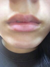 笑うと上唇がなくなる 薄くなる 人ってたまにいるけど そういう人って少し Yahoo 知恵袋