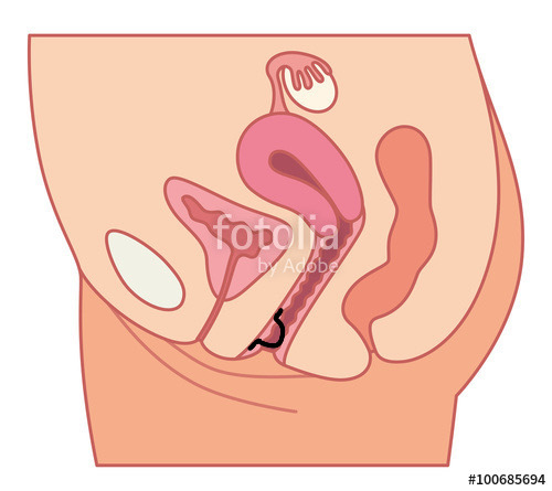 膣のしこりというか イボのようなものについてですわたしは20歳で処 Yahoo 知恵袋