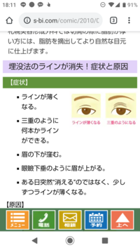 ２回目の埋没を考えています ３年前に埋没をして まだ糸が残った状態 Yahoo 知恵袋