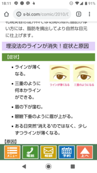 二重まぶたの埋没についていくつか質問させてください 二重まぶたの埋没が片目だ Yahoo 知恵袋