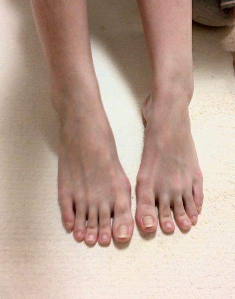 足の指長いですか 痩せると同時になんか足の指が長いと言われるようになり Yahoo 知恵袋