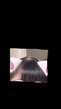 中3女子です 小学生まではいつも髪を降ろしていたので禿げてい Yahoo 知恵袋