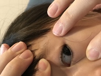 5歳の子供の白目に黒い点みたいなのがあります 特に痛みはないみたいですが ギ Yahoo 知恵袋