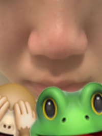 中学3年女子です 鼻の黒ずみがひどいです 画像あり 小鼻の横もぶ Yahoo 知恵袋